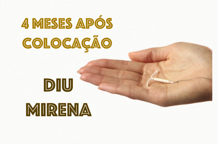 4 meses após o DIU Mirena