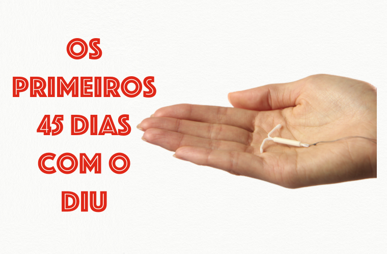 45 primeiros dias com o DIU Mirena