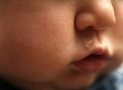 baby-with-runny-nose baby-with-runny-nose