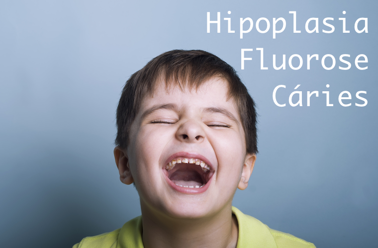 Cárie X Hipoplasia dentária X Fluorose – entenda a diferença